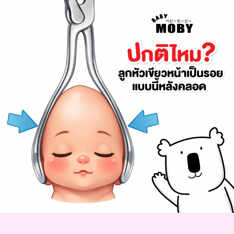ลูกหัวเขียว หน้าเป็นรอยหลังคลอด ปกติไหม?